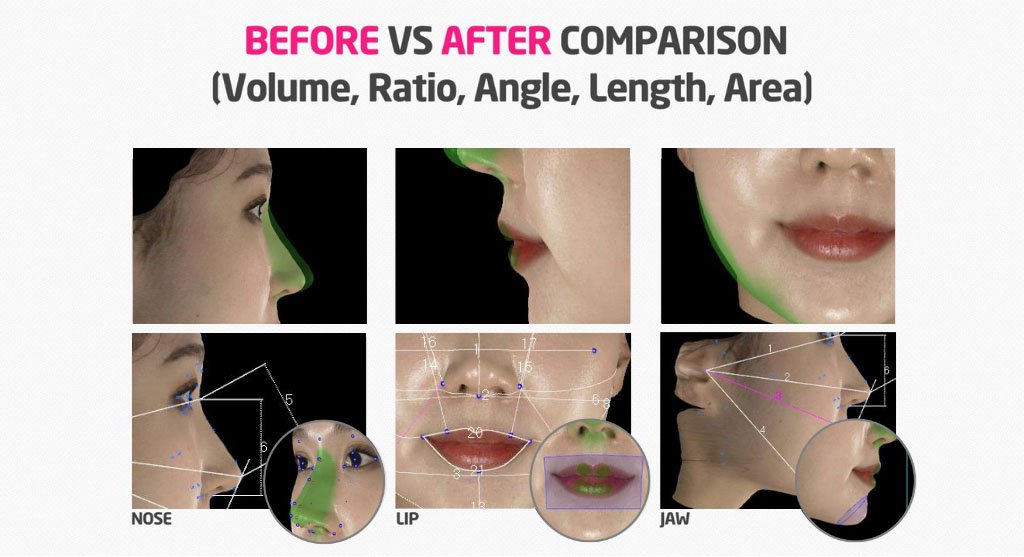 นวัตกรรม MORPHEUS 3D